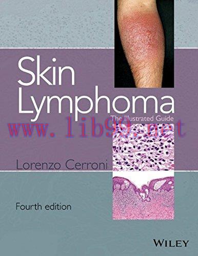 [AME]Skin Lymphoma: The Illustrated Guide