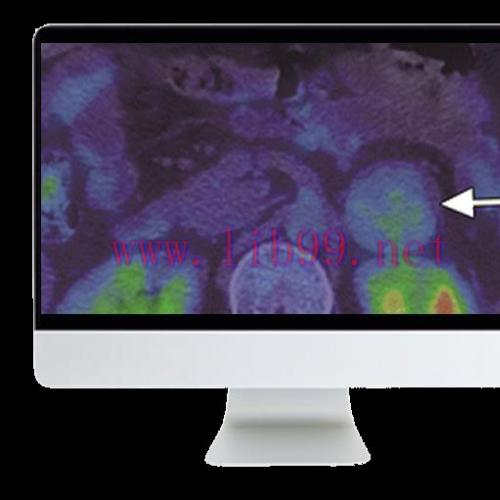 [AME]Breakthroughs in Nuclear Medicine for Neurology and Oncology 2021 (CME VIDEOS)