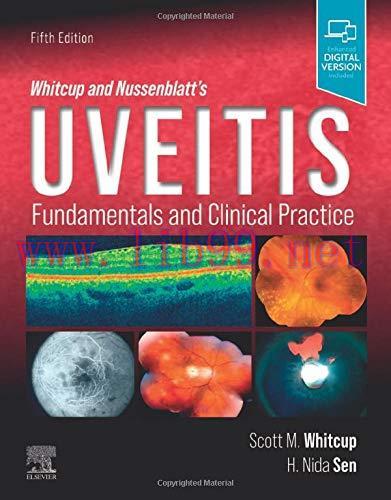 [AME]Whitcup and Nussenblatt’s Uveitis: Fundamentals and Clinical Practice, 5th edition (Origin...