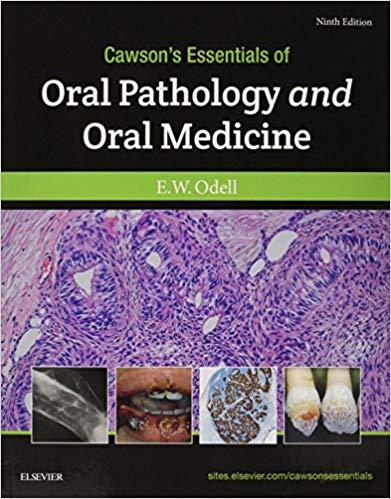 Cawson’s Essentials of Oral Pathology and Oral Medicine 9th Edition