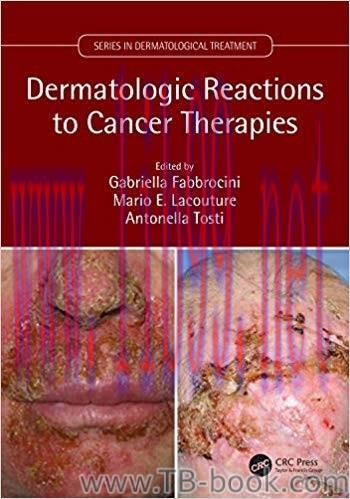 Dermatologic Reactions to Cancer Therapies 1st Edition by Gabriella Fabbrocini