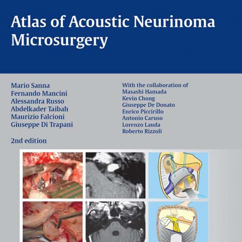 Atlas of Acoustic Neurinoma Microsurgery 2nd - Hamada, Masashi.,Sanna, M_