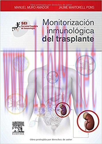 [AME]Monitorización inmunológica del trasplante: Sociedad Española de Inmunología (Spanish Edit...