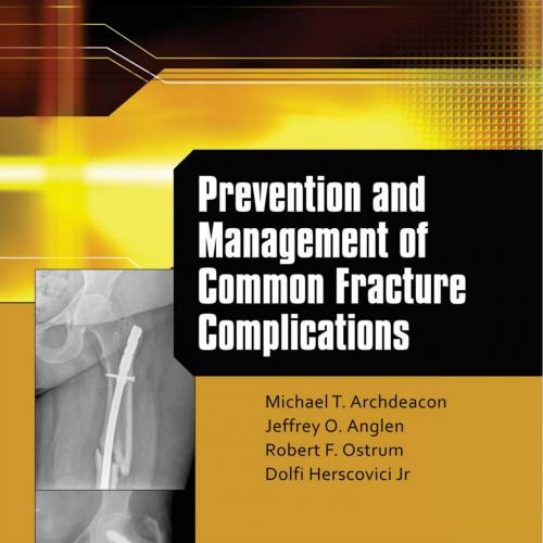 Prevention and Management of Common Fracture Complications