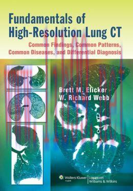 [AME]Fundamentals of High-Resolution Lung CT (EPUB)