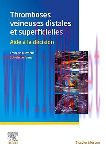 [AME]Thromboses veineuses distales et superficielles: Aide à la décision (French Edition) (Orig...