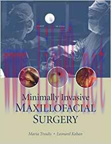 [PDF]Minimally Invasive Maxillofacial Surgery