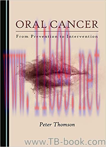 Oral Cancer 1st Edition by Peter Thomson