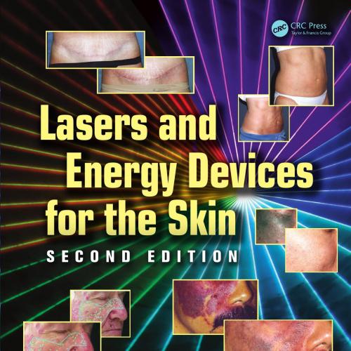 Lasers and Energy Devices for the Skin, 2nd Edition