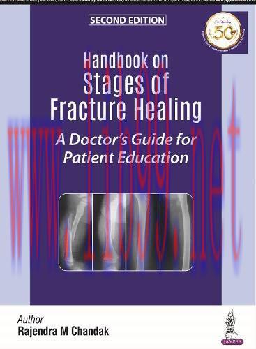 [AME]Handbook on Stages of Fracture Healing: A Doctor's Guide for Patient Education, 2nd Editio...