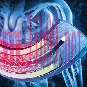 [AME]Comprehensive Review and Update_ of What’s New in Vascular and Endovascular Surgery 2021 (...