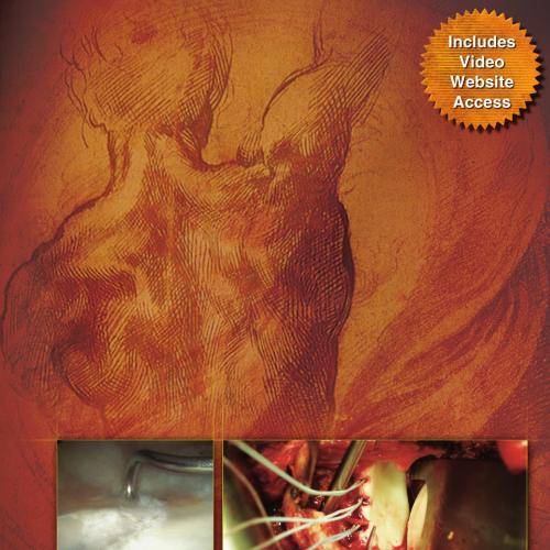 Management of the Unstable Shoulder Arthroscopic and Open Repair