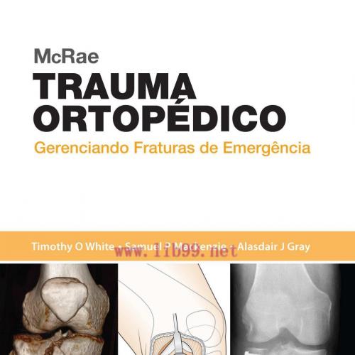 [AME]McRae Trauma Ortopédico (Portuguese Brazilian) (PDF)