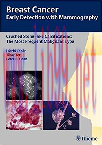 [PDF]Breast Cancer - Early Detection with Mammography e, 1e [Thieme] [2008]