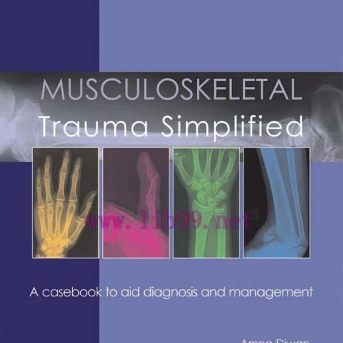 [AME]Musculoskeletal Trauma Simplified (EPUB)