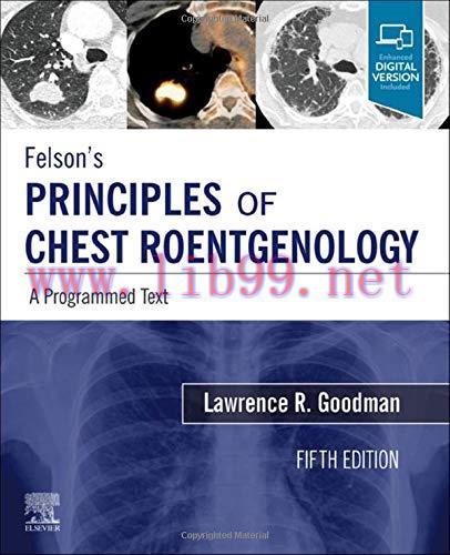 [AME]Felson's Principles of Chest Roentgenology, A Programmed Text: A Programmed Text (PDF+Vide...