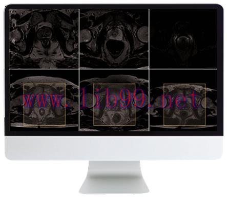 [AME]ARRS Pearls and Pitfalls in Prostate and Pelvic Imaging 2021 (CME VIDEOS)