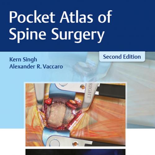 Thieme_ Pocket Atlas of Spine Surgery - Singh, Kern; Alexander R. Vaccaro