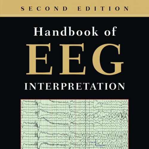 Handbook of EEG Interpretation 2nd Edition - William O. Tatum IV